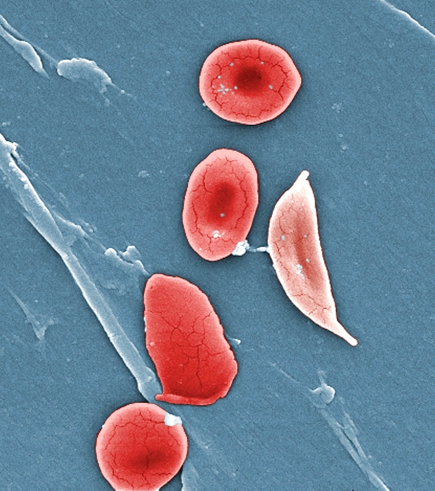Blood cell morphology
