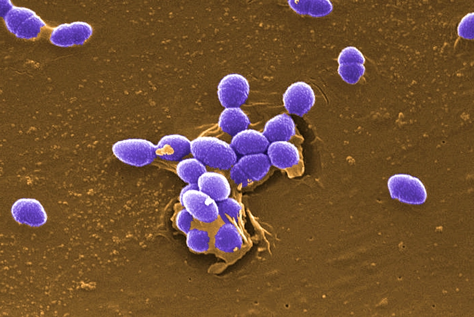 Bacteria gram positive