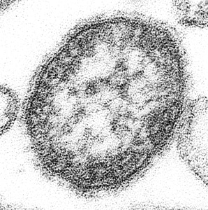 Genus measles paramyxovirus photo