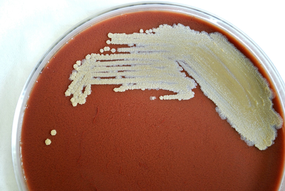 Disease infection 