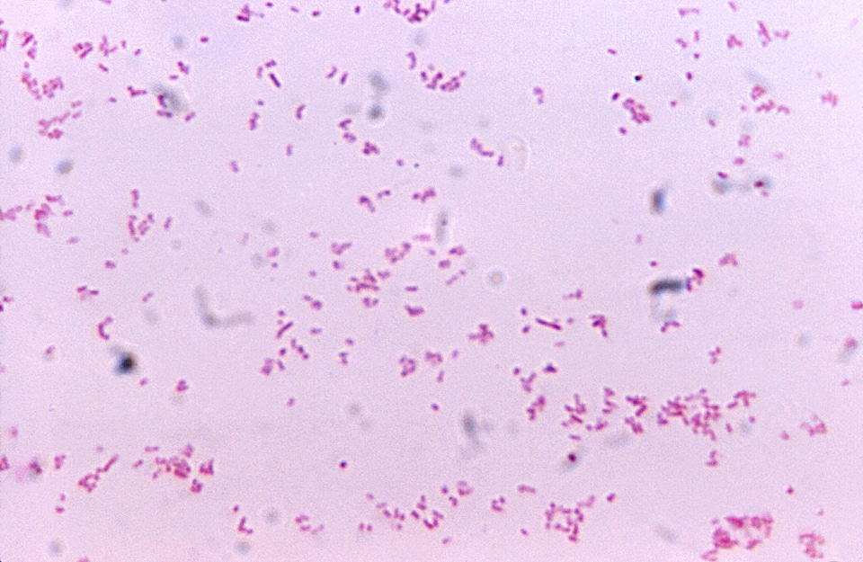 Gram negative presence