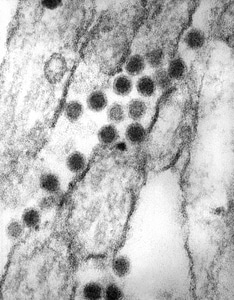 Family flavivirus genus photo