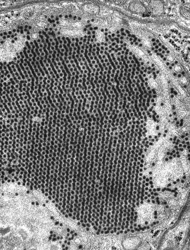 Electron electron micrograph transfer