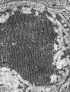 Electron electron micrograph transfer