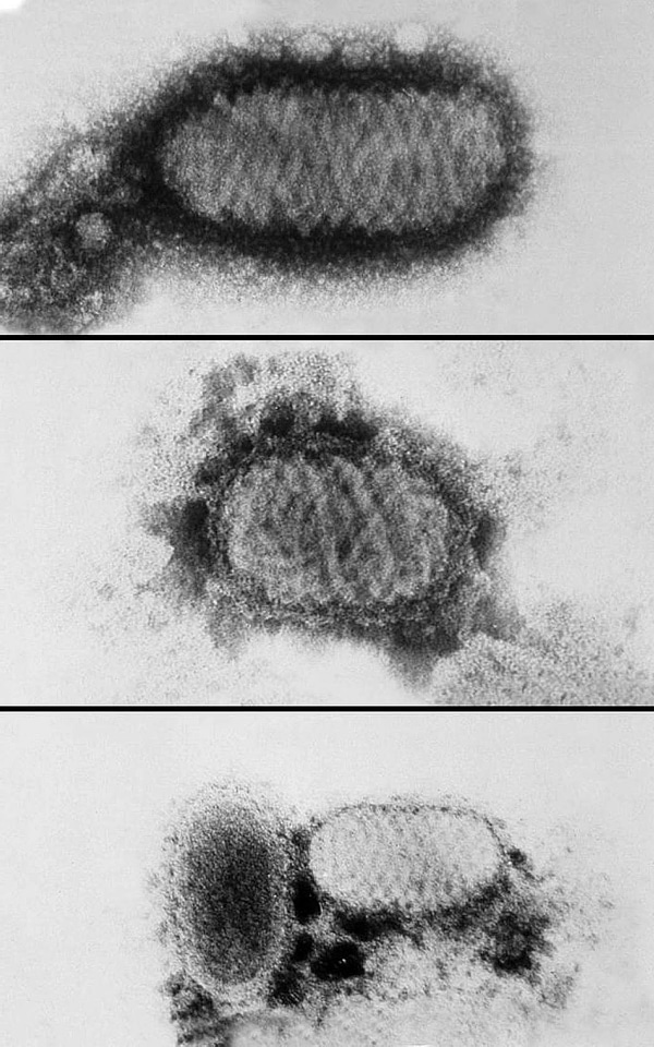 Common found morphologic