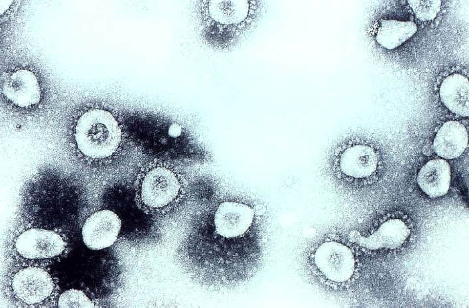 Disease infectious disease diseases