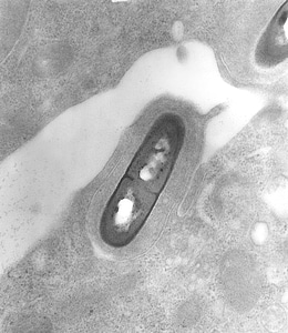 Electron electron micrograph listeria