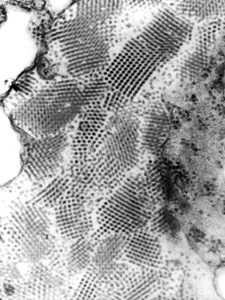 Virus  