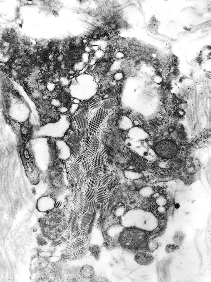 Genome positive sense