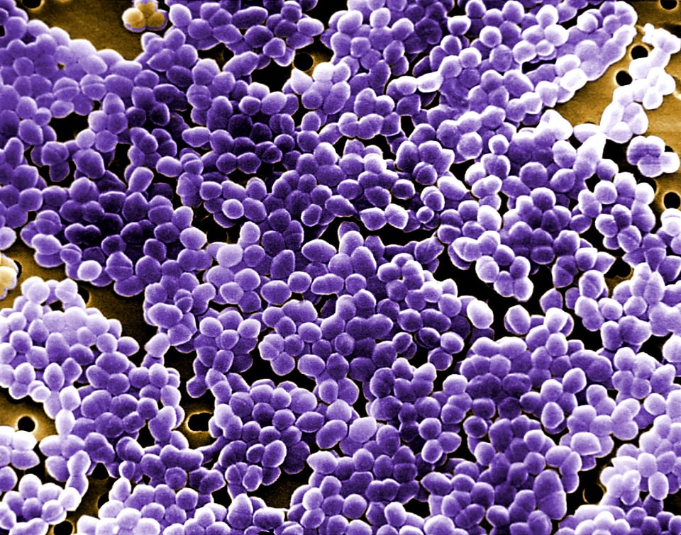 Bacteremia infection leading