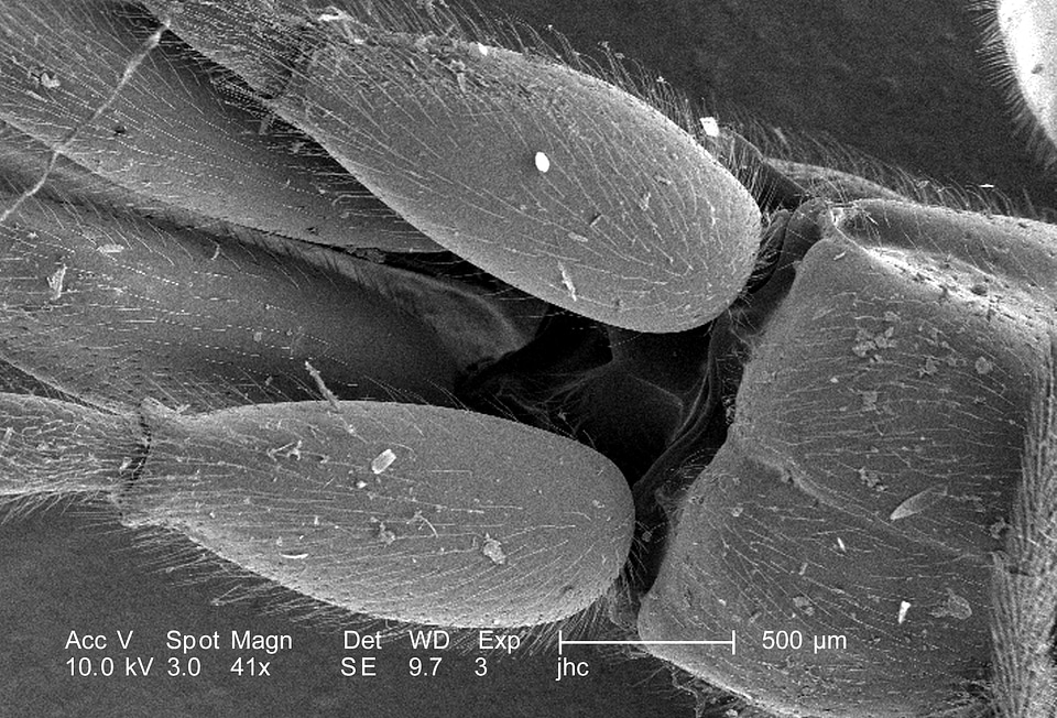 Bug debris electron micrograph photo