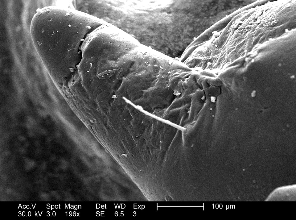 Bug characteristic legs