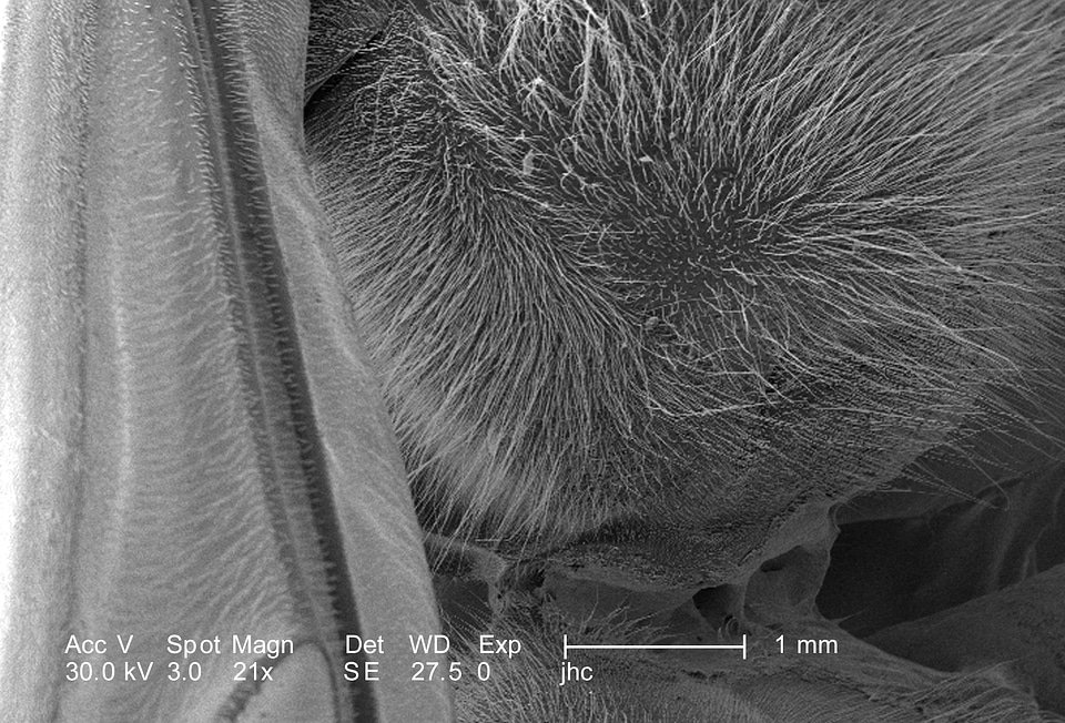Abdomen body petiole