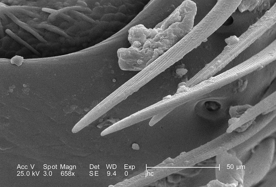 Details female magnification