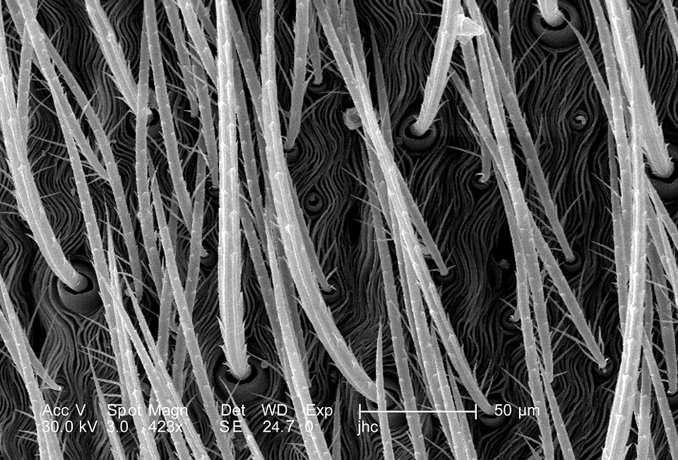 Abdominal brown exoskeleton