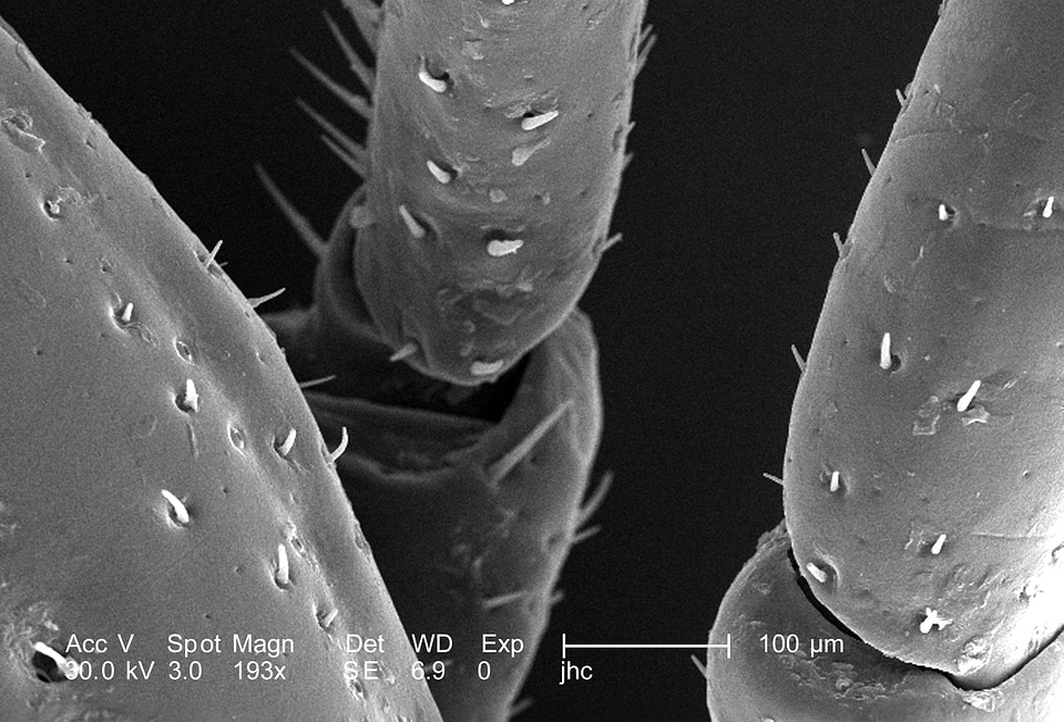Electron electron micrograph male