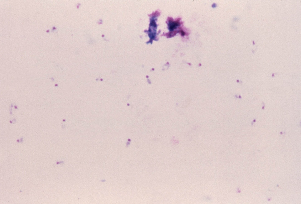 Blood cervical smear comma