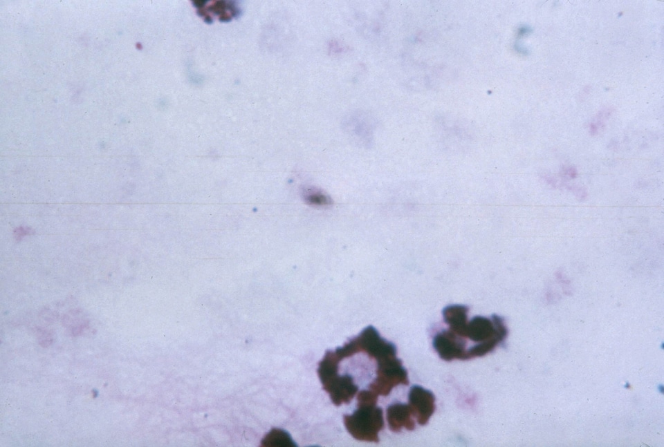 Cytoplasm film gametocyte