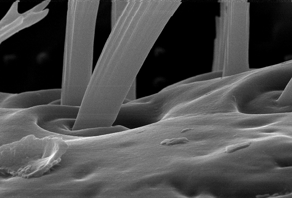 Bedbug morphology surface