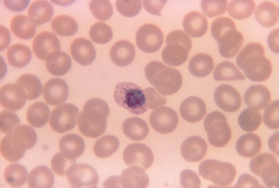 Chromatin film parasit