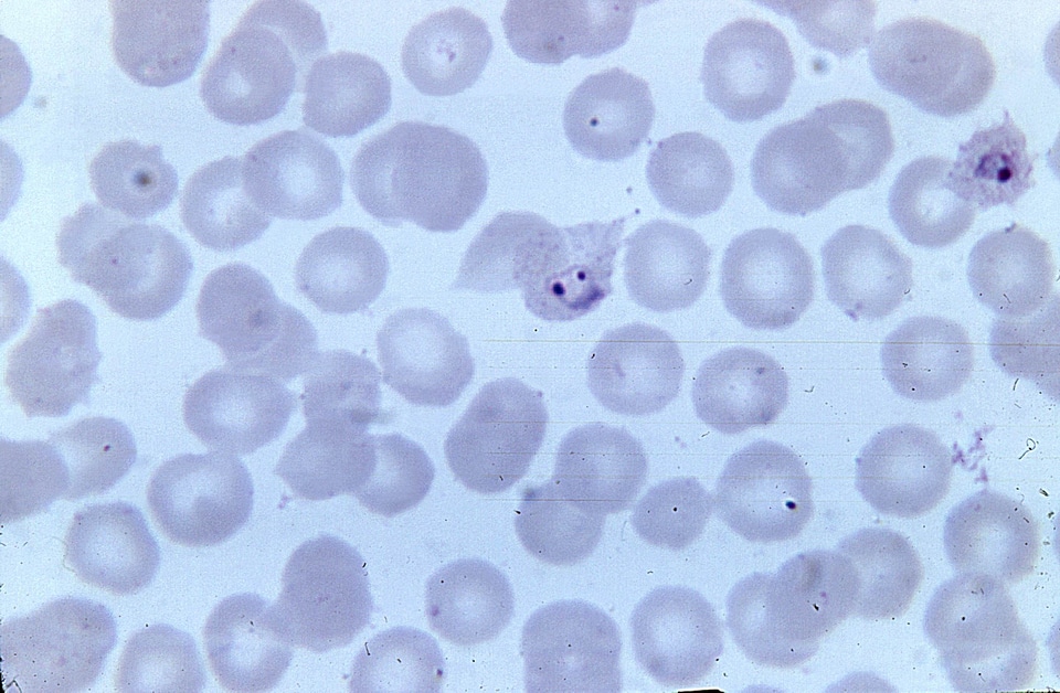Chromatin double magnification