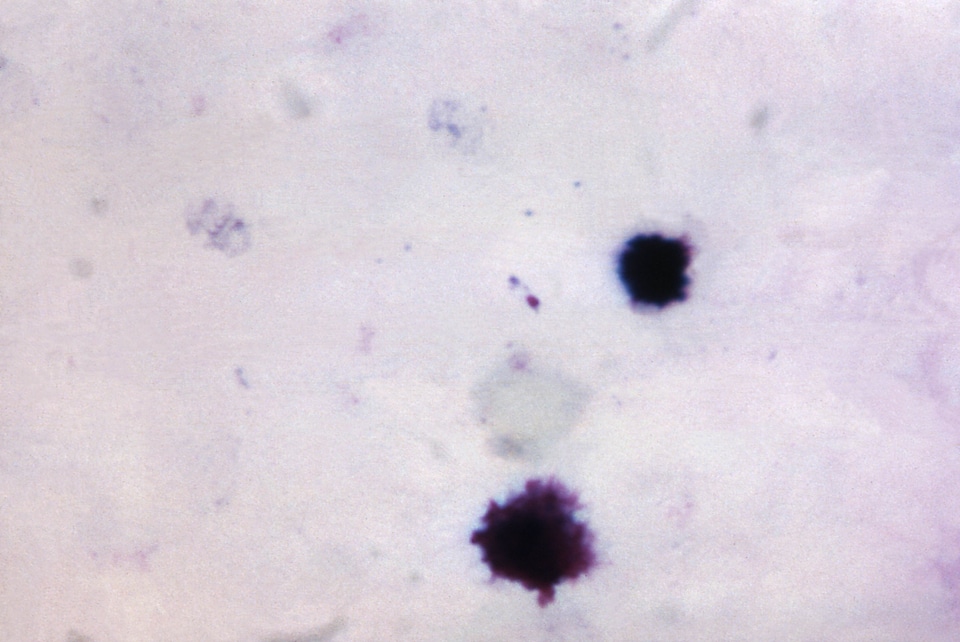 Film pigment plasmodium