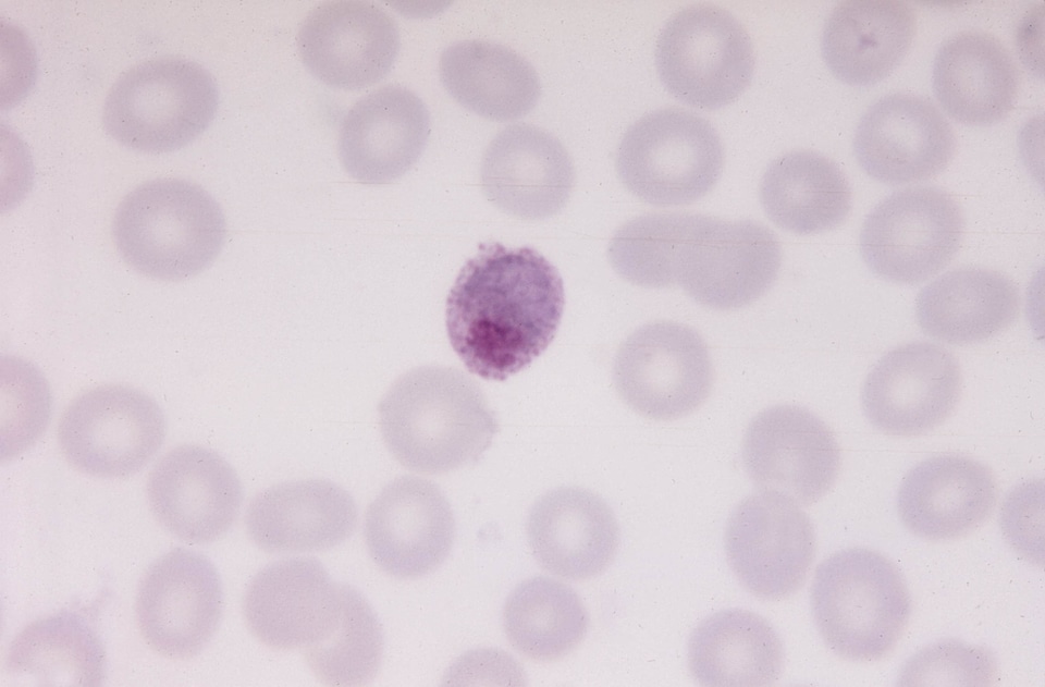 Film parasit photomicrograph