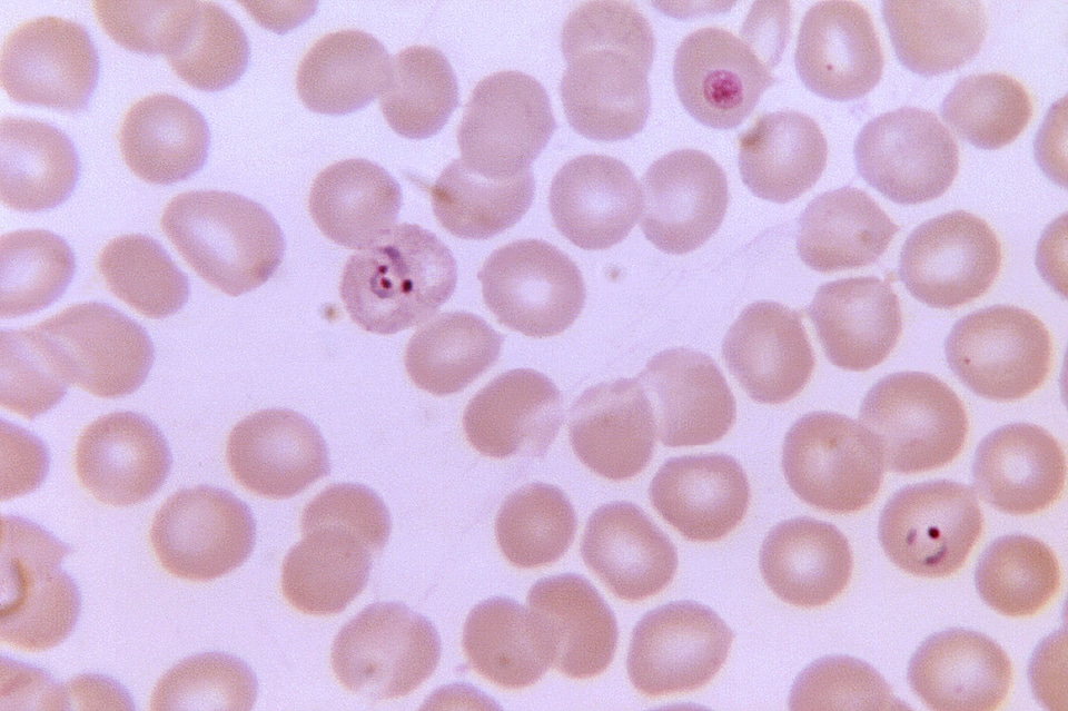 Chromatin law plasmodium