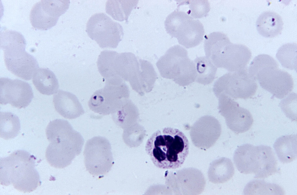 Magnification photomicrograph plasmodium photo