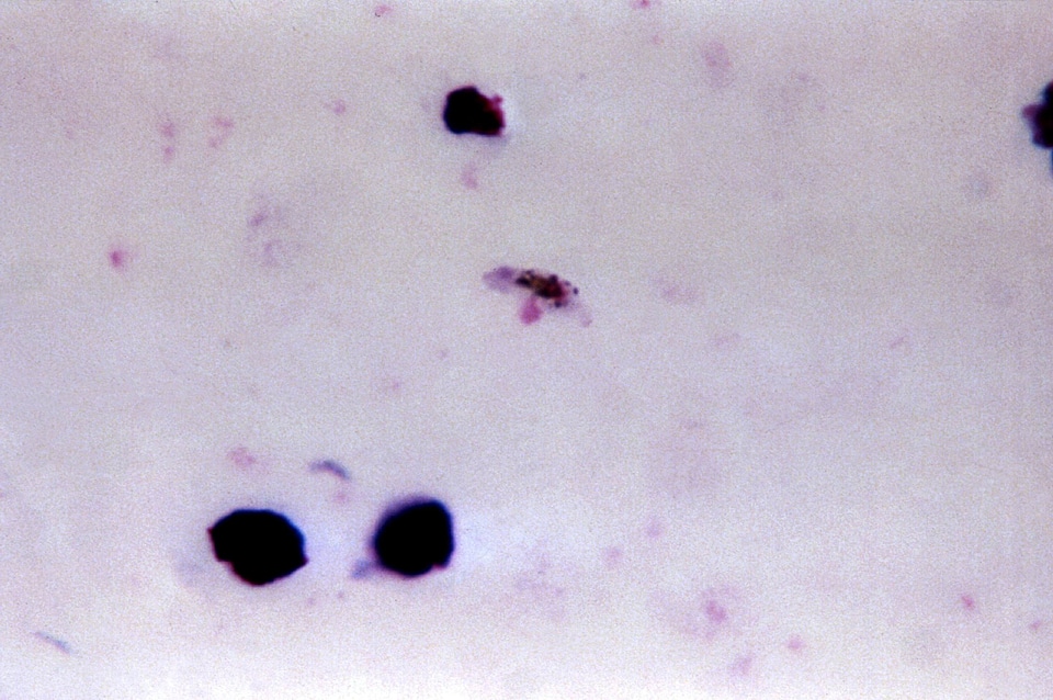 Gametocyte plasmodium 
