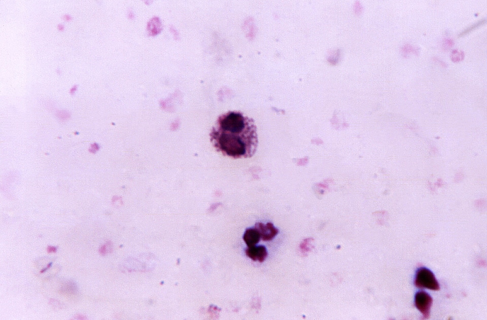 Blood blood cell cell