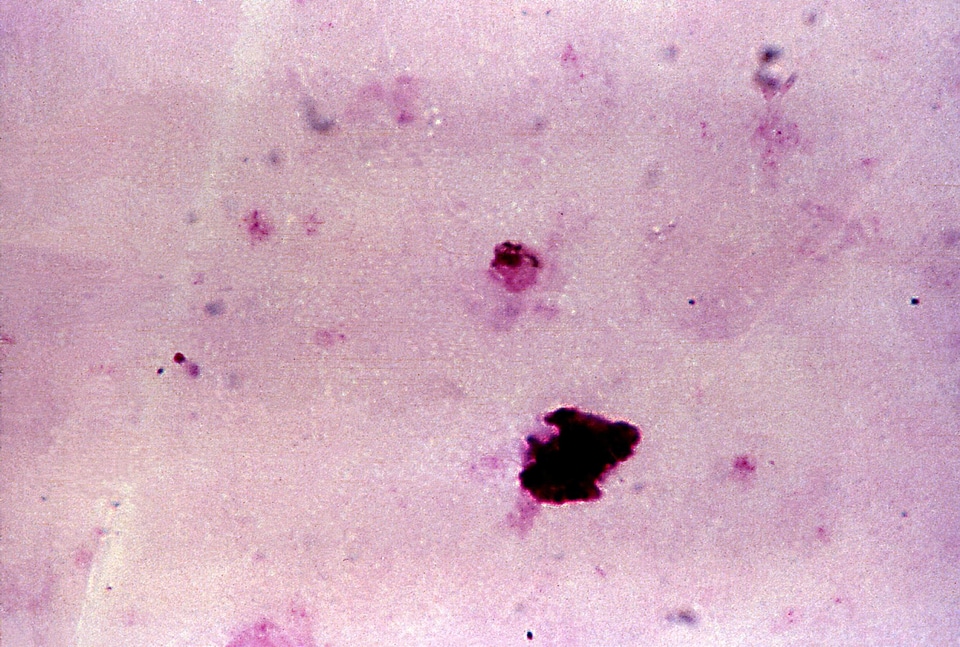 Chromatin gametocyte plasmodium