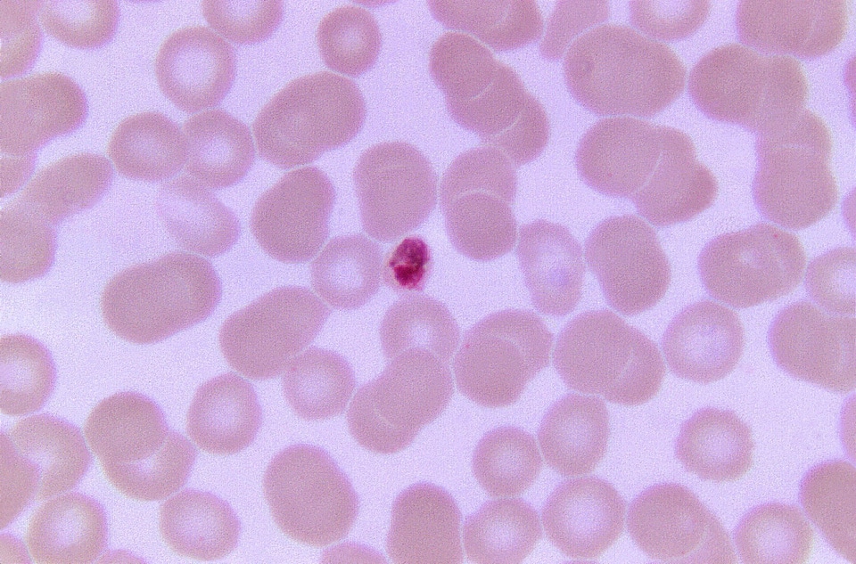 Little plasmodium scrub