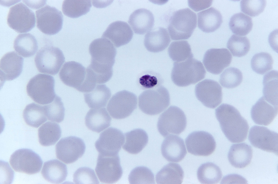 Compact photomicrograph plasmodium