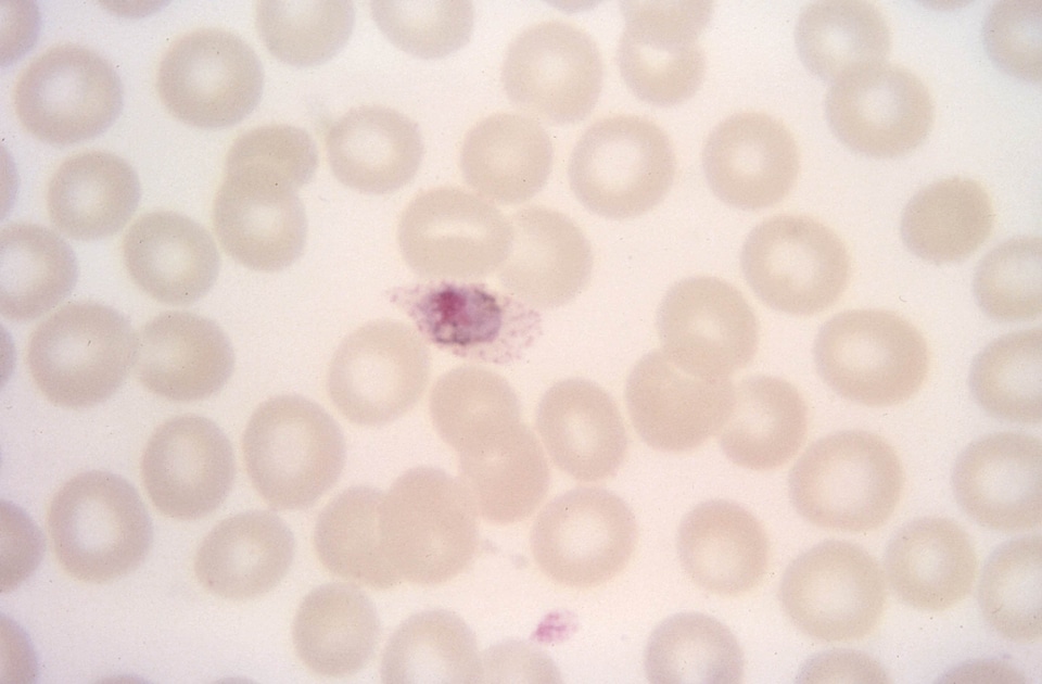 Crescent photomicrograph plasmodium