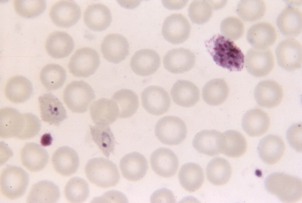 Chromatin photomicrograph rings