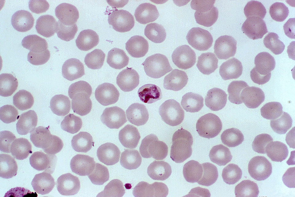 Crescent photomicrograph plasmodium