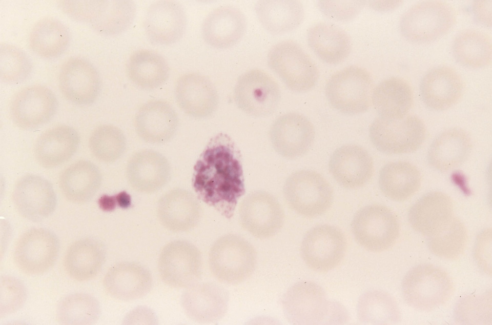 Photomicrograph plasmodium twelve