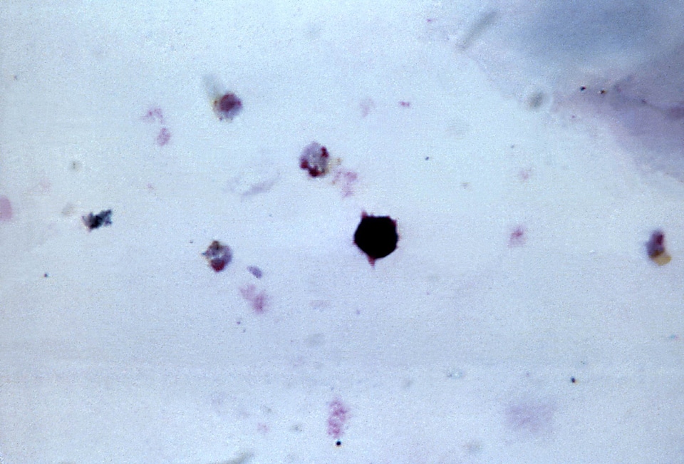 Chromatin crescent cytoplasm