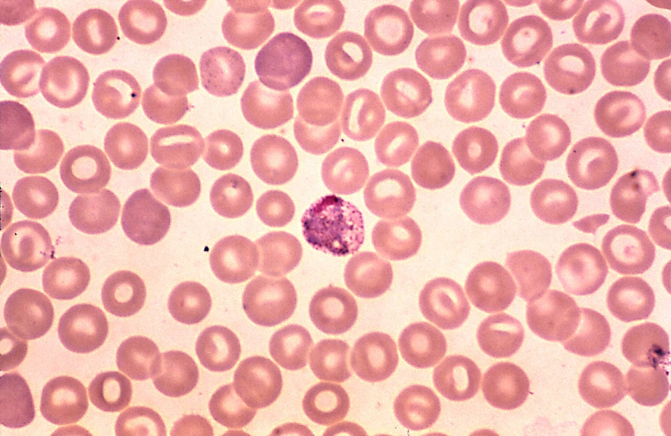 Parasit plasmodium scrub