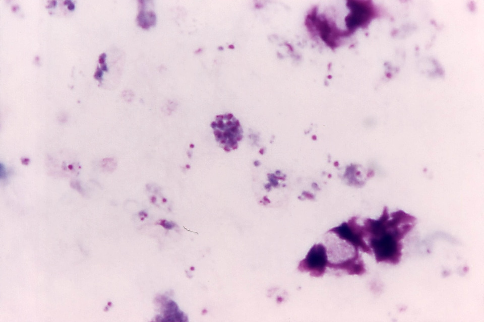 Film magnification scrub