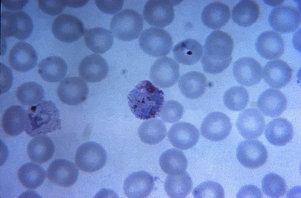 Center film plasmodium