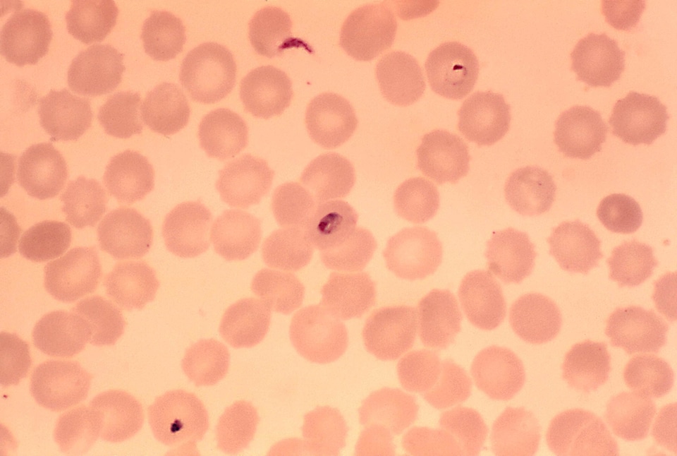 Crescent form parasit