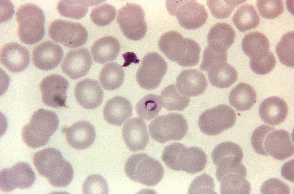 Photomicrograph plasmodium ring photo