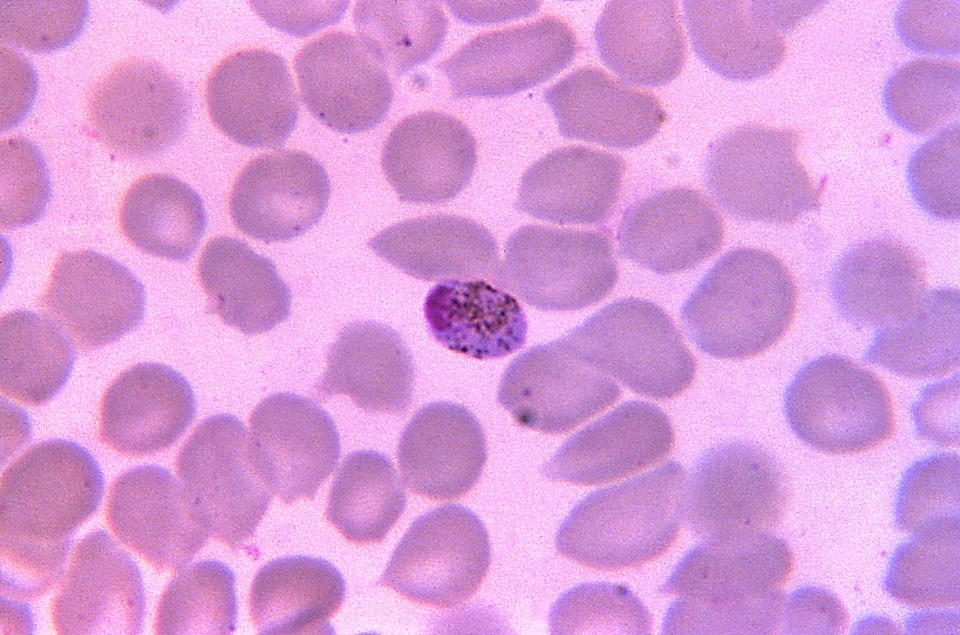 Photomicrograph plasmodium 