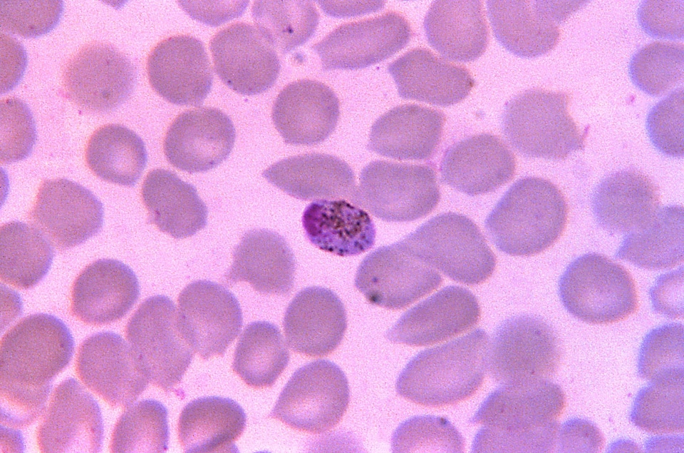 Photomicrograph plasmodium photo