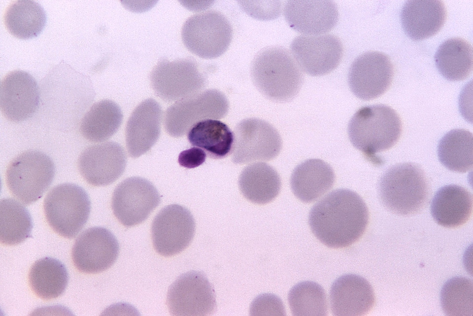 Photomicrograph plasmodium scrub