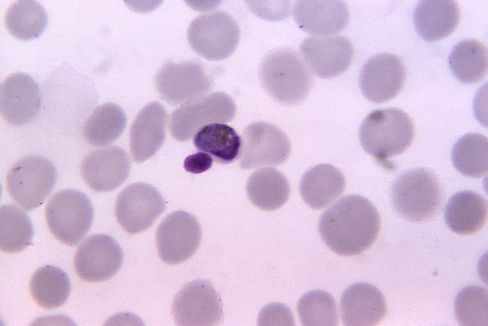 Photomicrograph plasmodium scrub photo