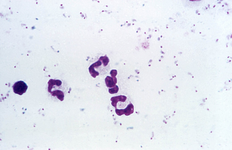 Form photomicrograph rings