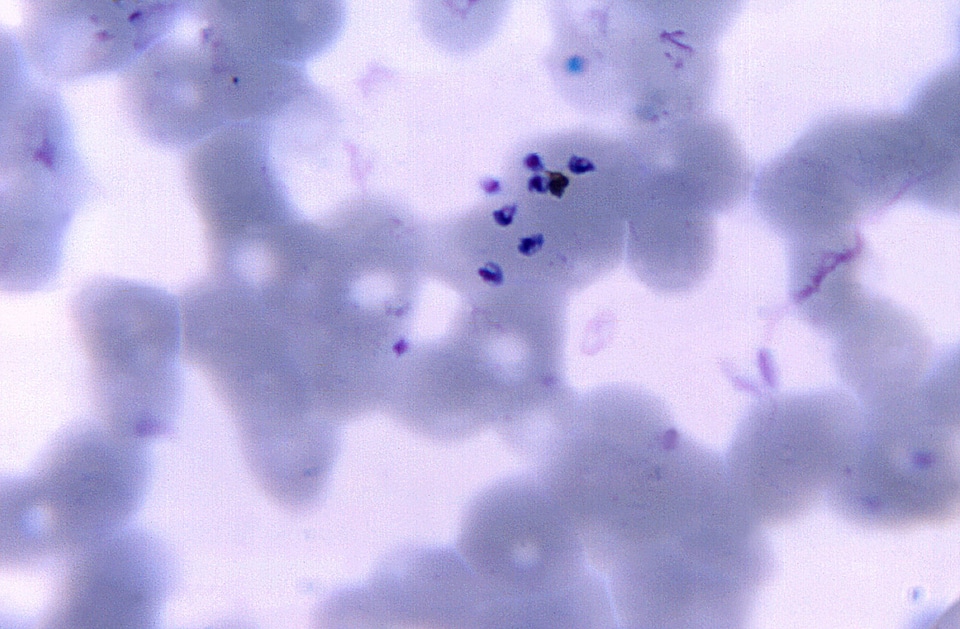 Blood cervical smear number